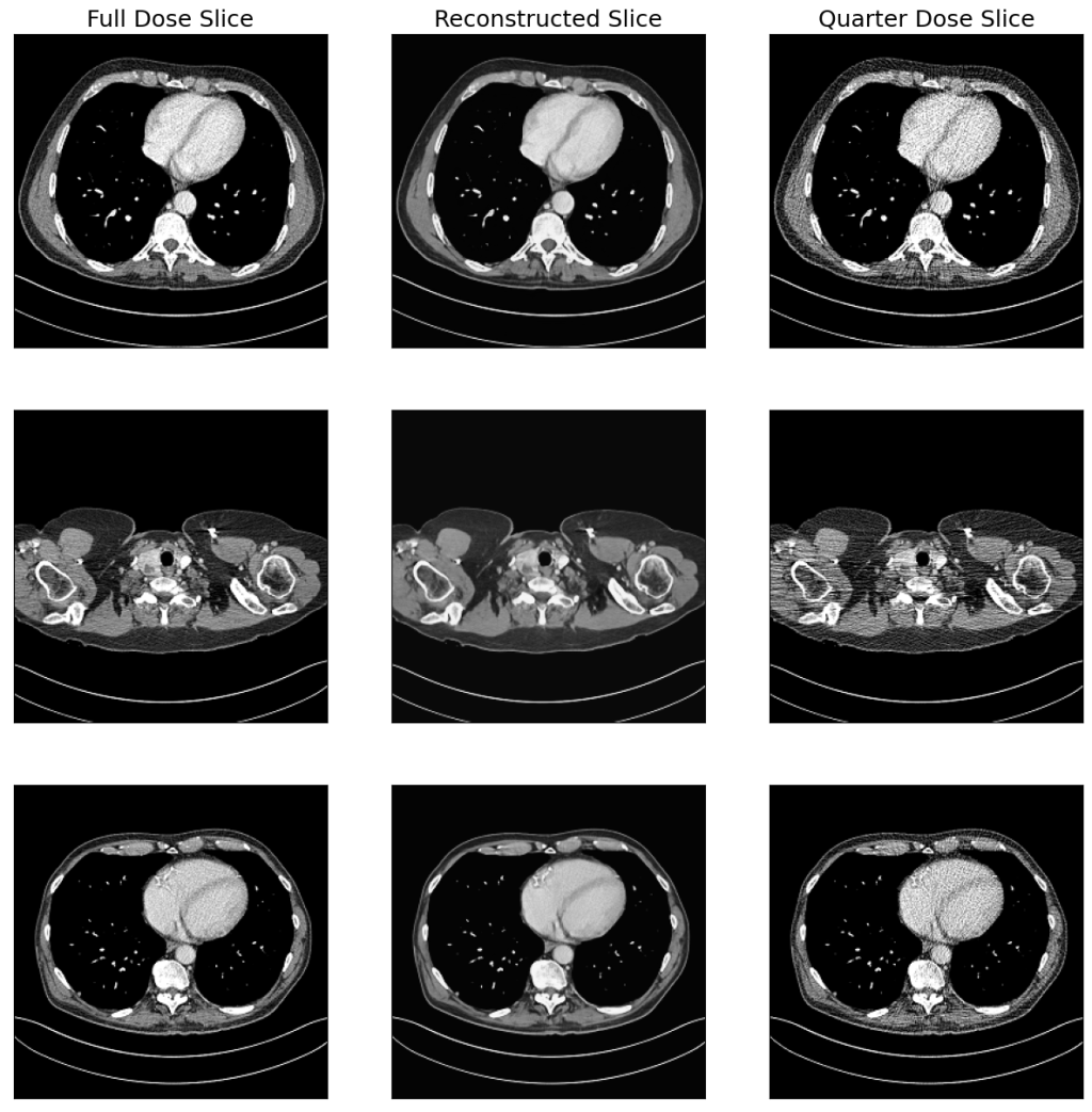 Deep Learning Enhancement of Low-Dose CT Images for Improved Diagnostic&nbsp;Accuracy